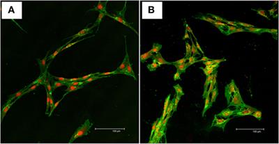 Donor-Matched Comparison of Chondrogenic Potential of Equine Bone Marrow- and Synovial Fluid-Derived Mesenchymal Stem Cells: Implications for Cartilage Tissue Regeneration